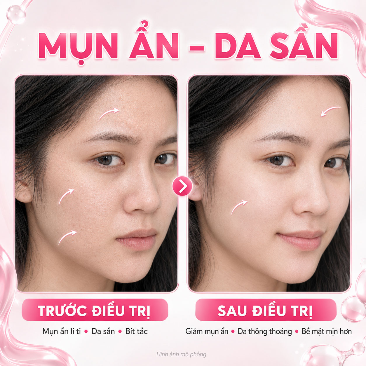 Kết quả trước sau 1