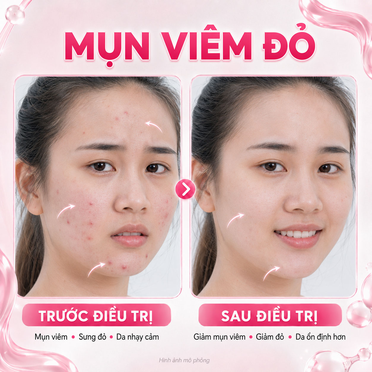 Kết quả trước sau 3