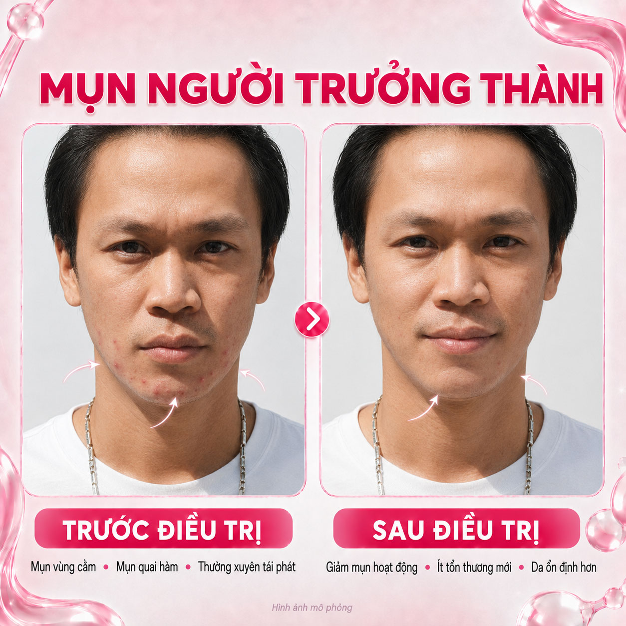 Kết quả trước sau 7