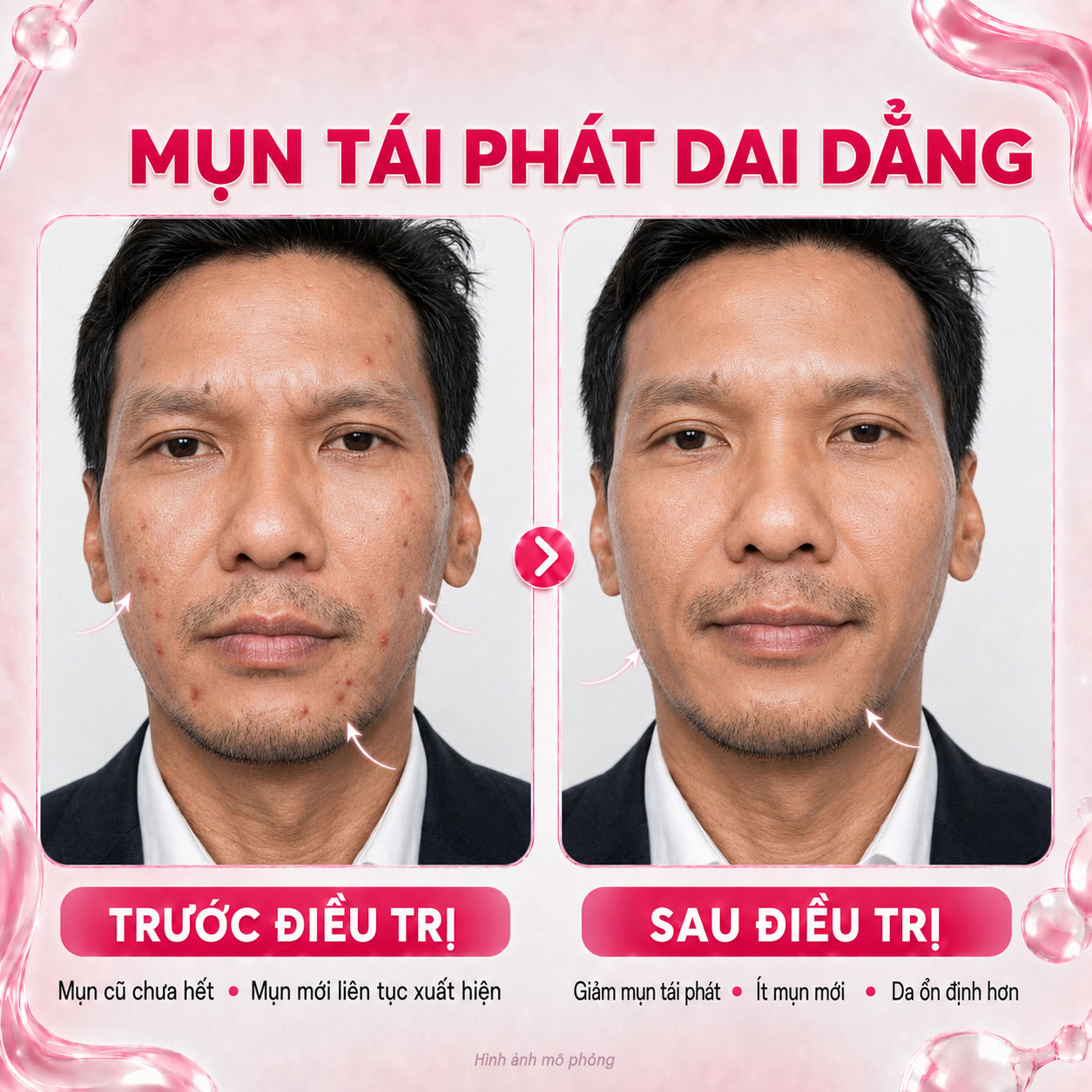 Kết quả trước sau 8