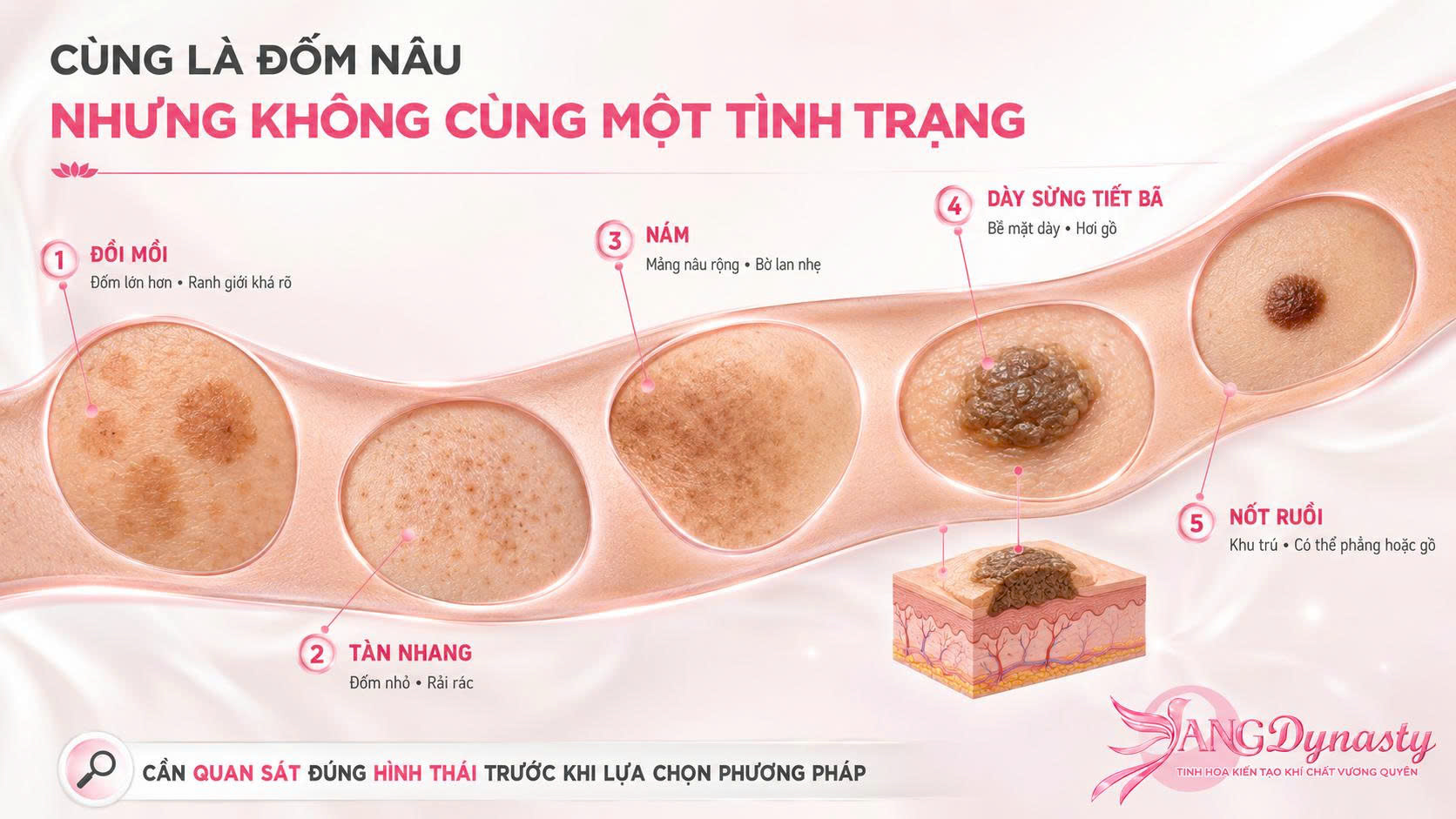 Trị Đồi Mồi