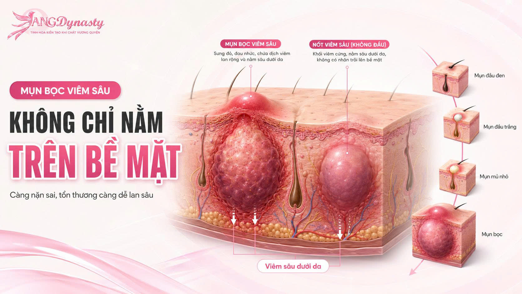 Trị Mụn Bọc Trị Mụn Bọc