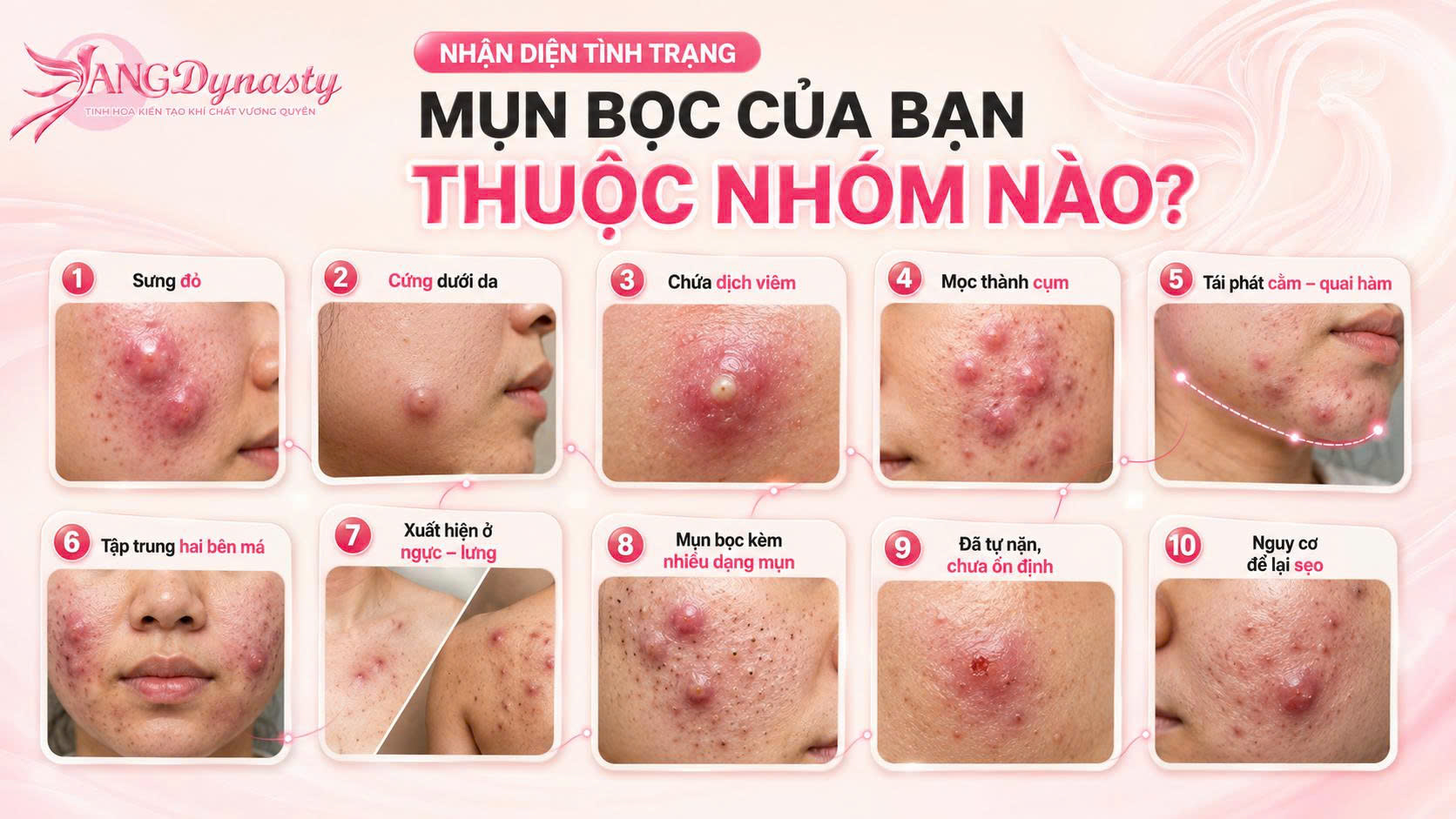 Trị Mụn Bọc Trị Mụn Bọc