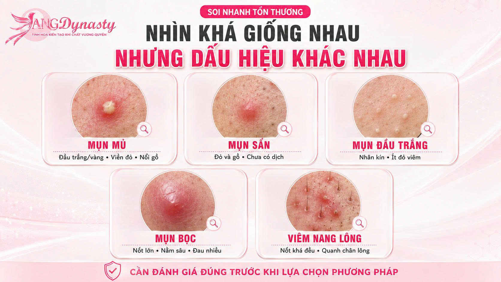 Trị Mụn Mủ Trị Mụn Mủ