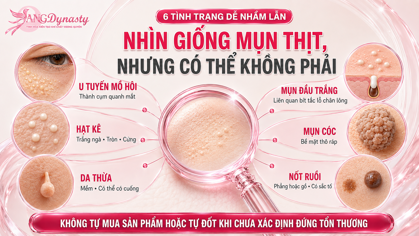 Trị Mụn Thịt Trị Mụn Thịt