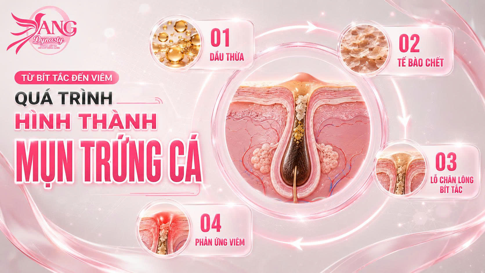 Trị Mụn Trứng Cá Trị Mụn Trứng Cá
