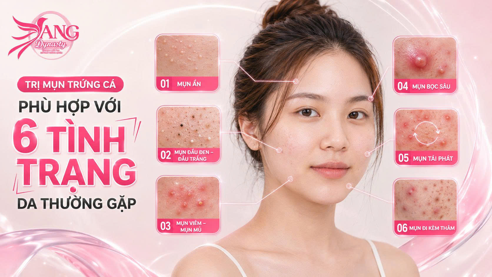 Trị Mụn Trứng Cá Trị Mụn Trứng Cá