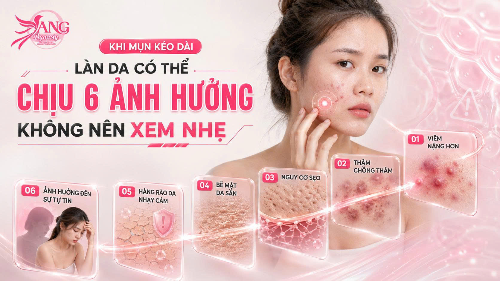 Trị Mụn Trứng Cá Trị Mụn Trứng Cá