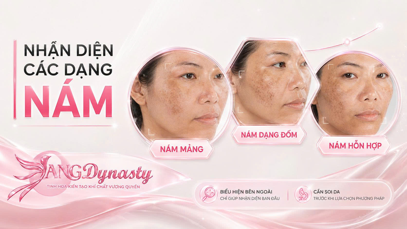 Trị Nám Da