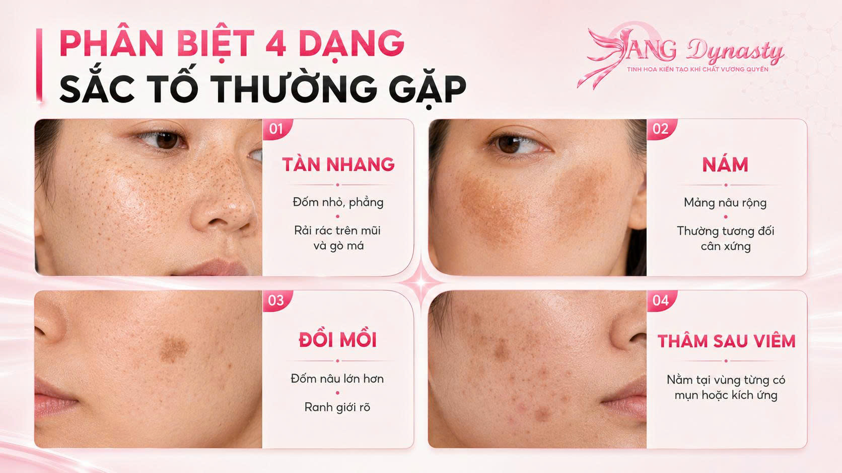 Trị Tàn Nhang