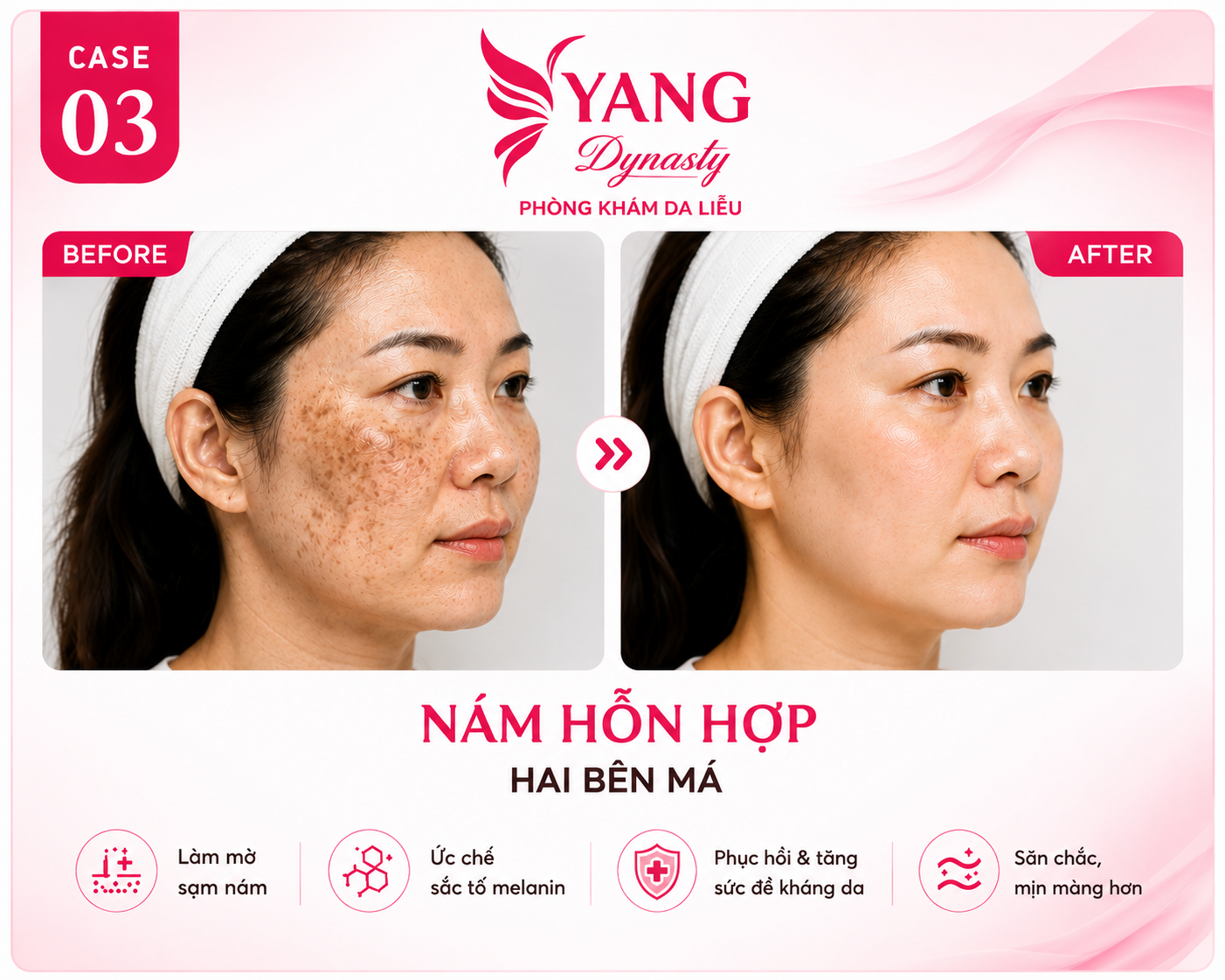 YANG Dynasty Case 03