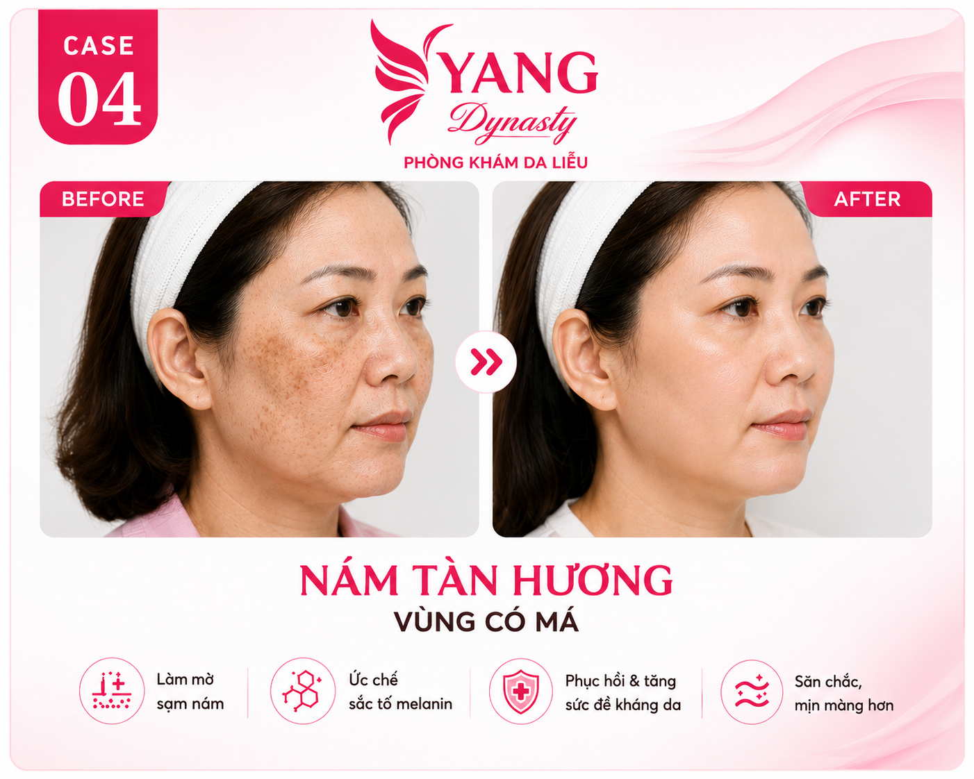YANG Dynasty Case 04