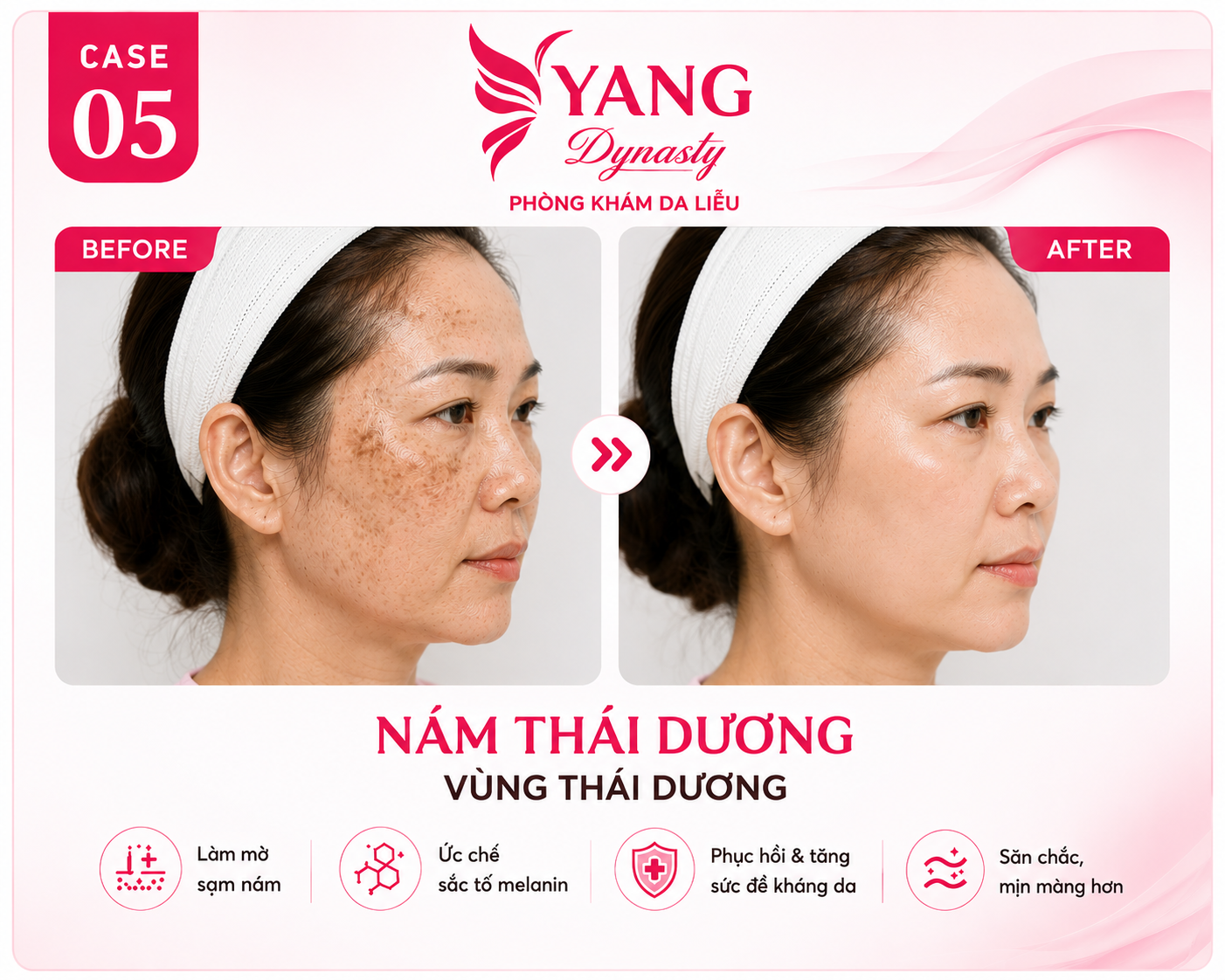 YANG Dynasty Case 05