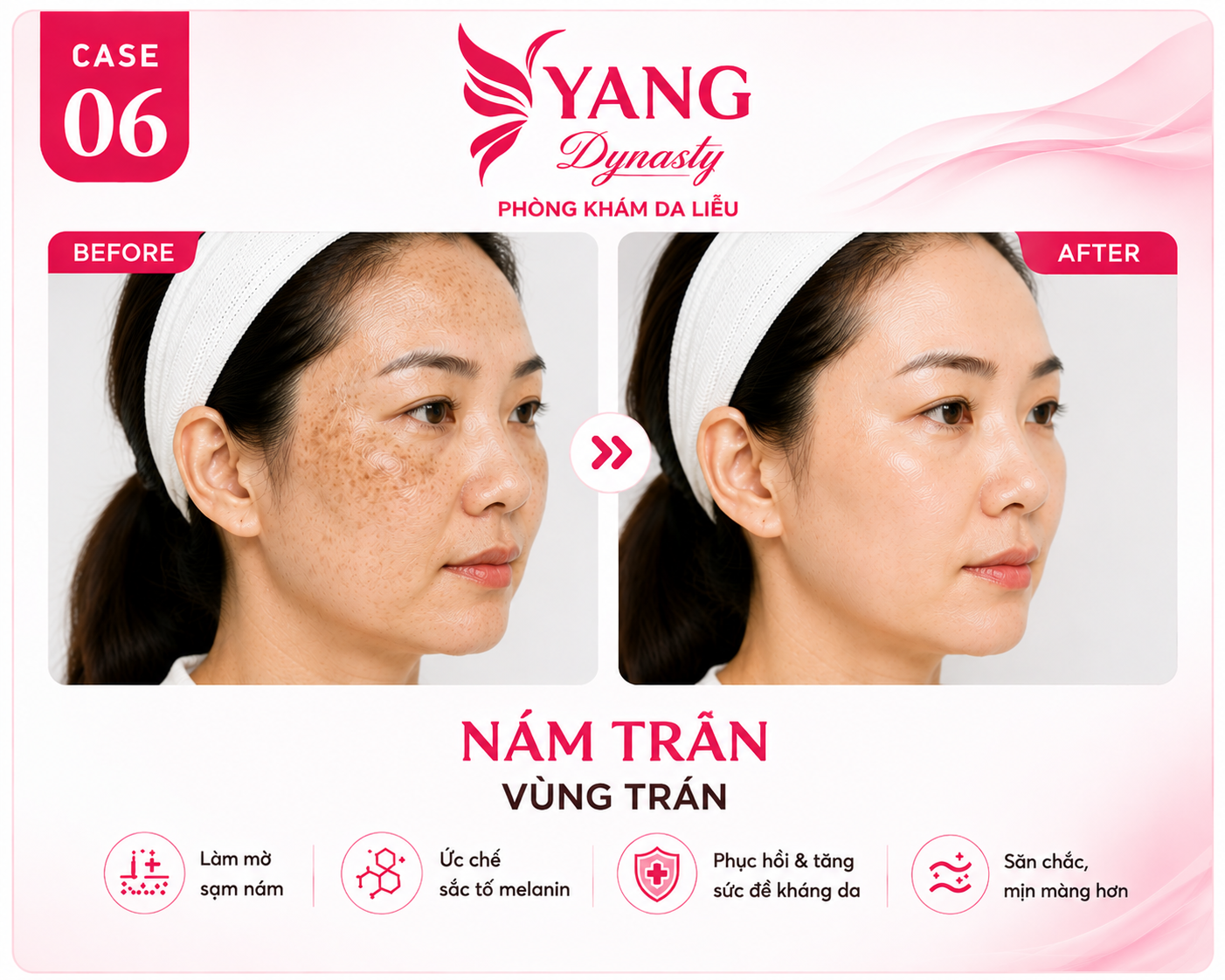 YANG Dynasty Case 06