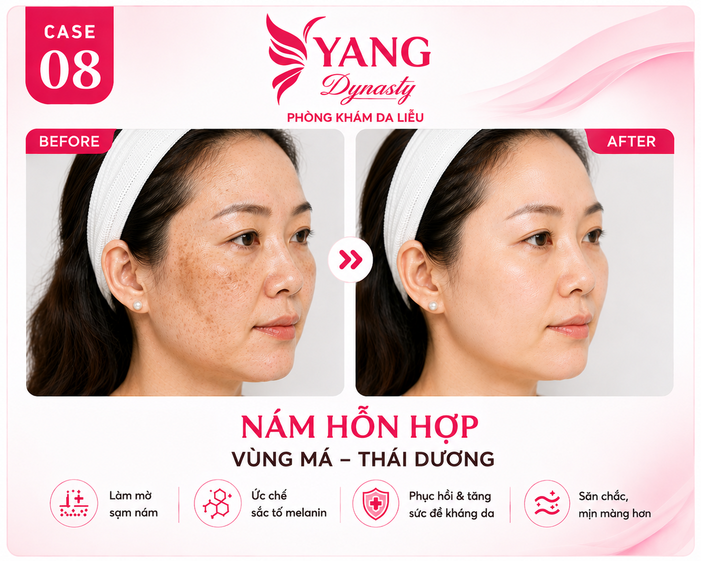 YANG Dynasty Case 08