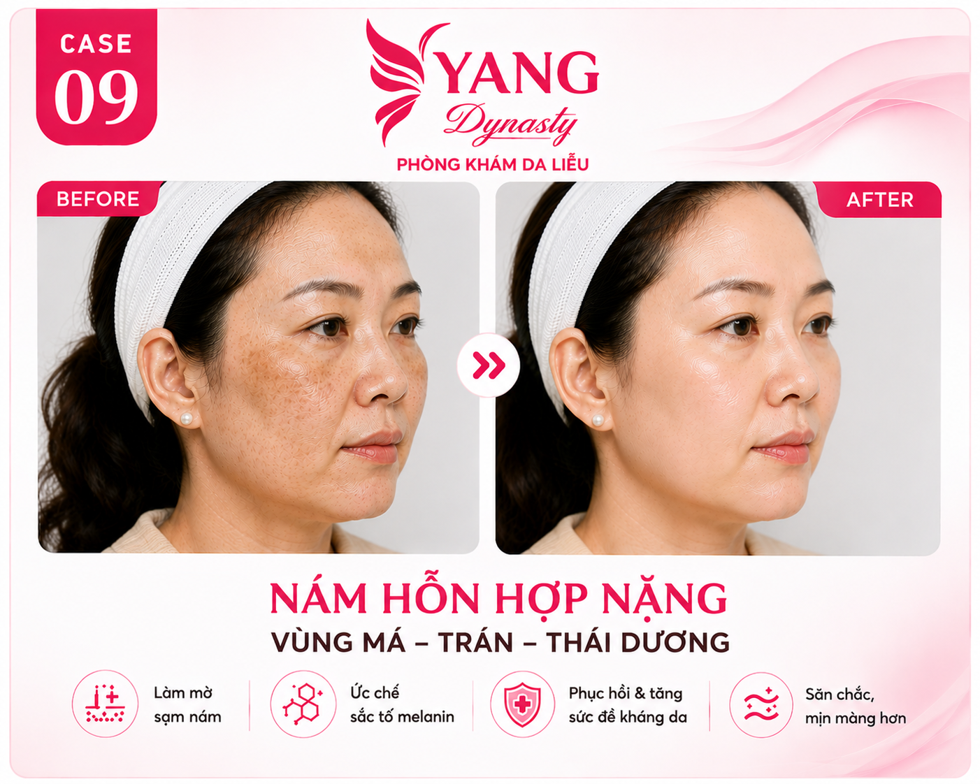 YANG Dynasty Case 09