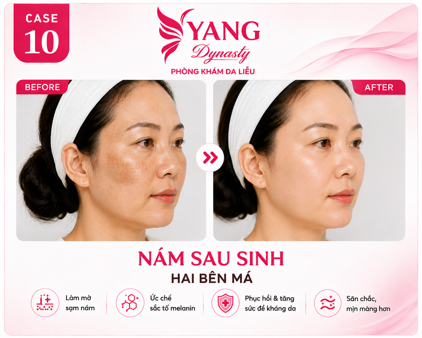YANG Dynasty Case 10