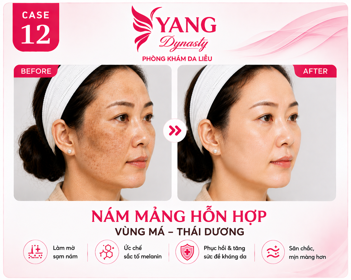 YANG Dynasty Case 12