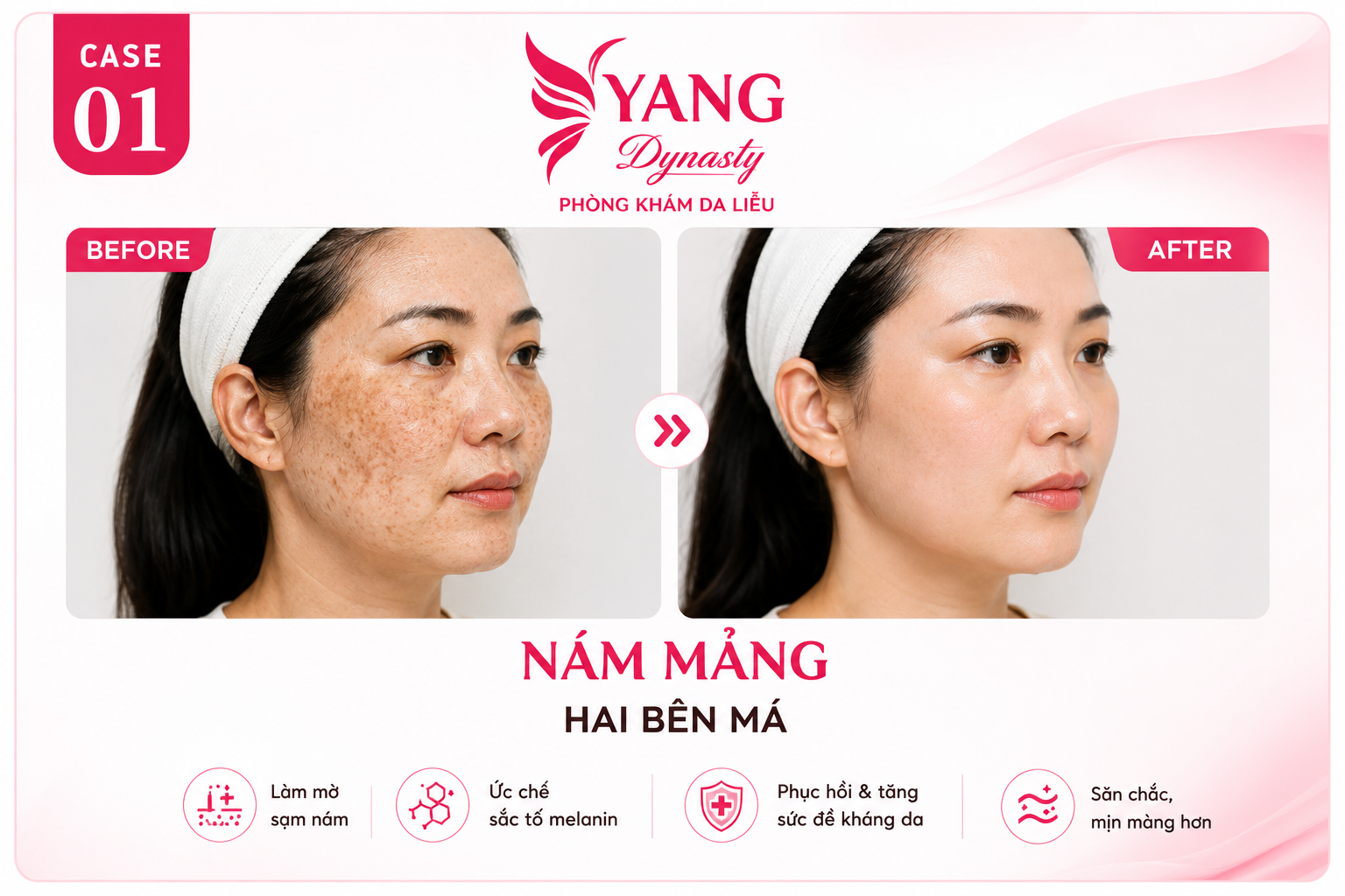 YANG Dynasty Case 01