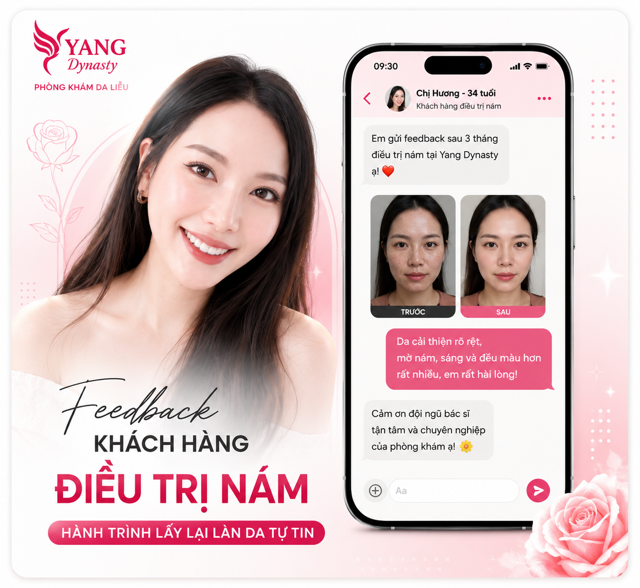 Feedback điều trị nám YANG Dynasty 01