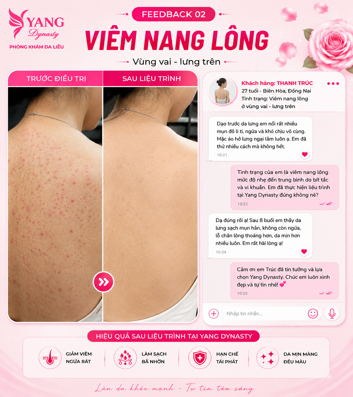 Feedback điều trị viêm nang lông YANG Dynasty 02