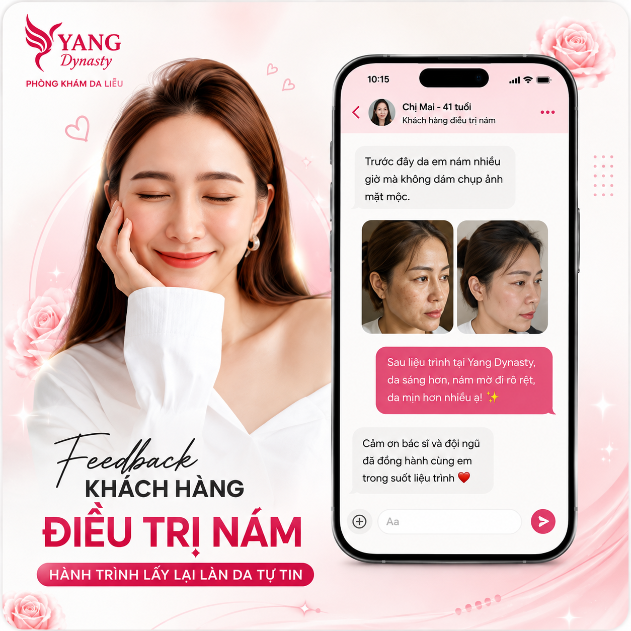 Feedback điều trị nám YANG Dynasty 02