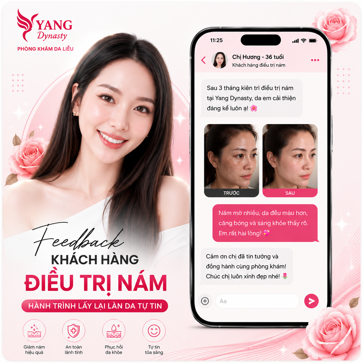 Feedback điều trị nám YANG Dynasty 04