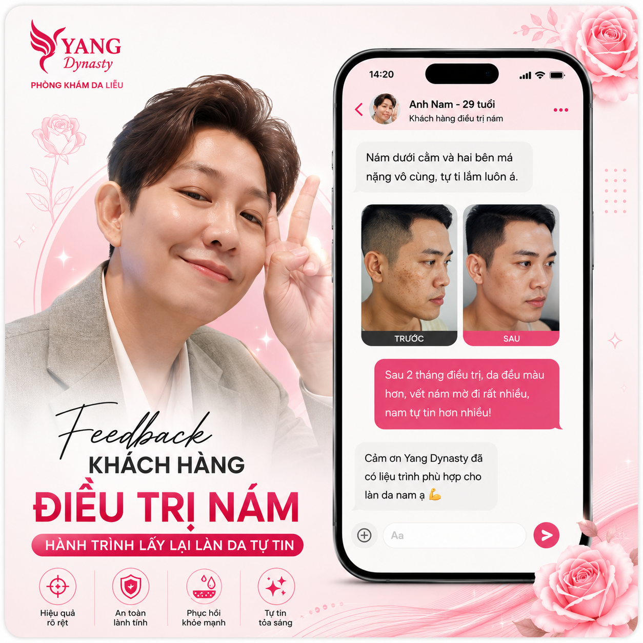 Feedback điều trị nám YANG Dynasty 05
