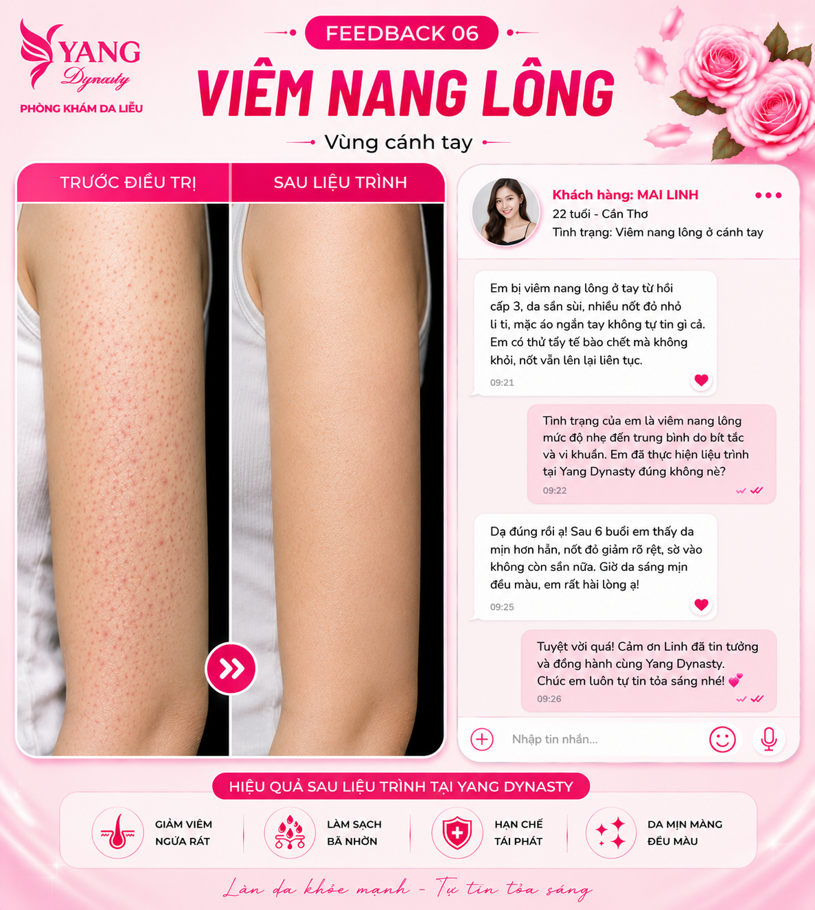 Feedback điều trị viêm nang lông YANG Dynasty 06