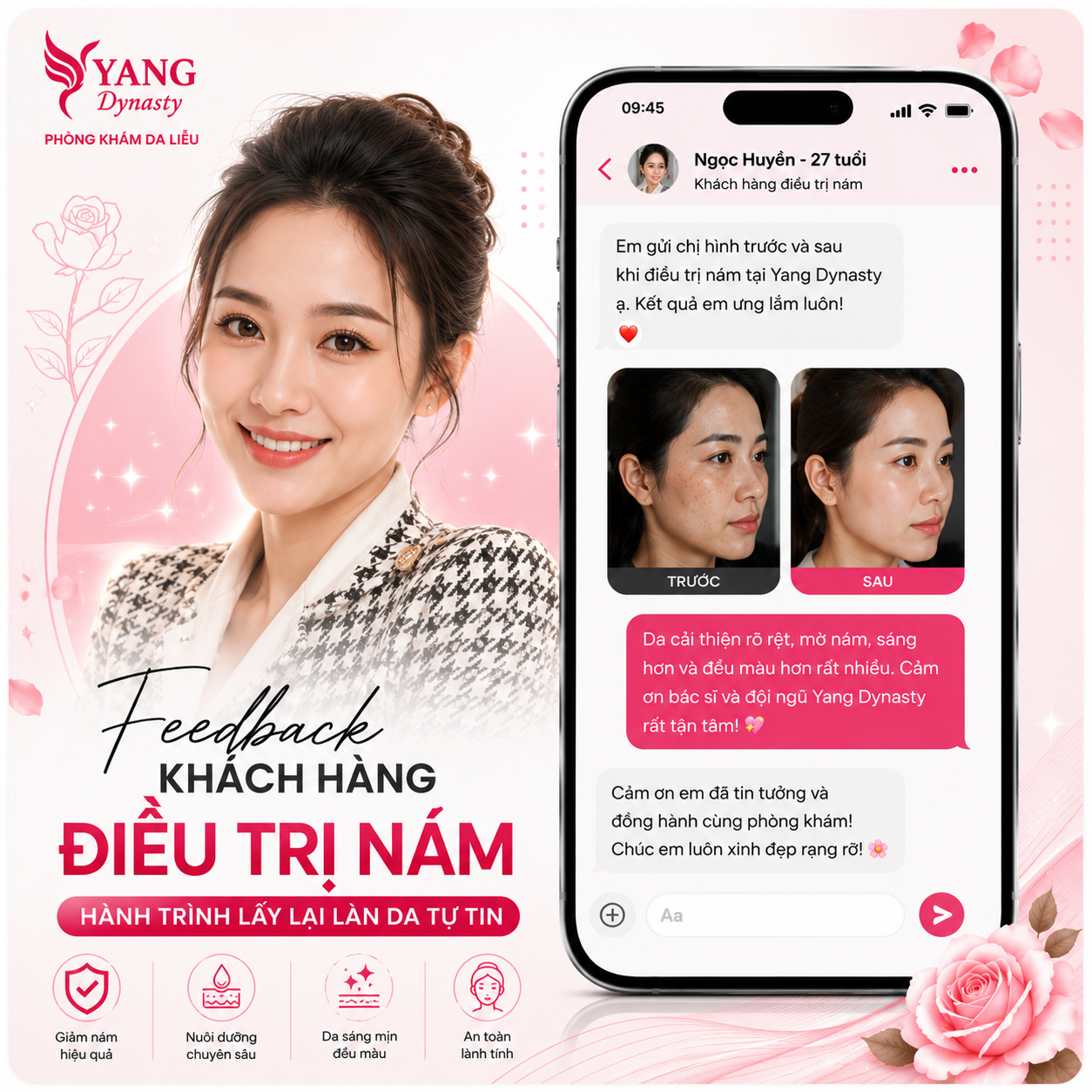 Feedback điều trị nám YANG Dynasty 06