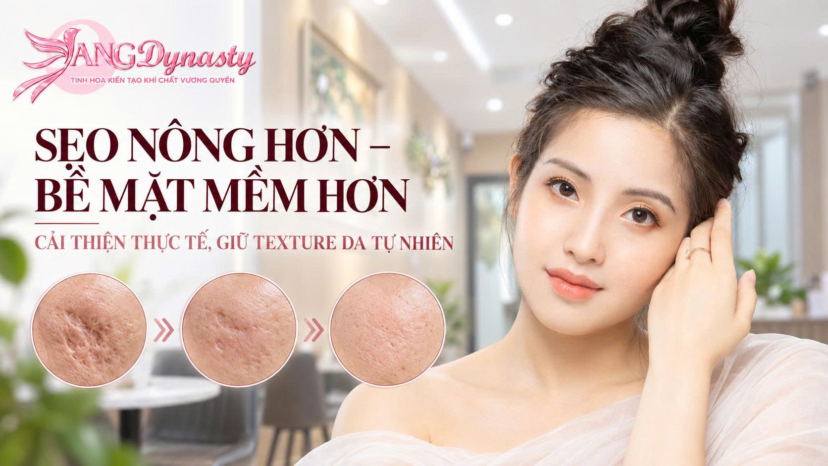 Trị Sẹo Lõm Trị Sẹo Lõm