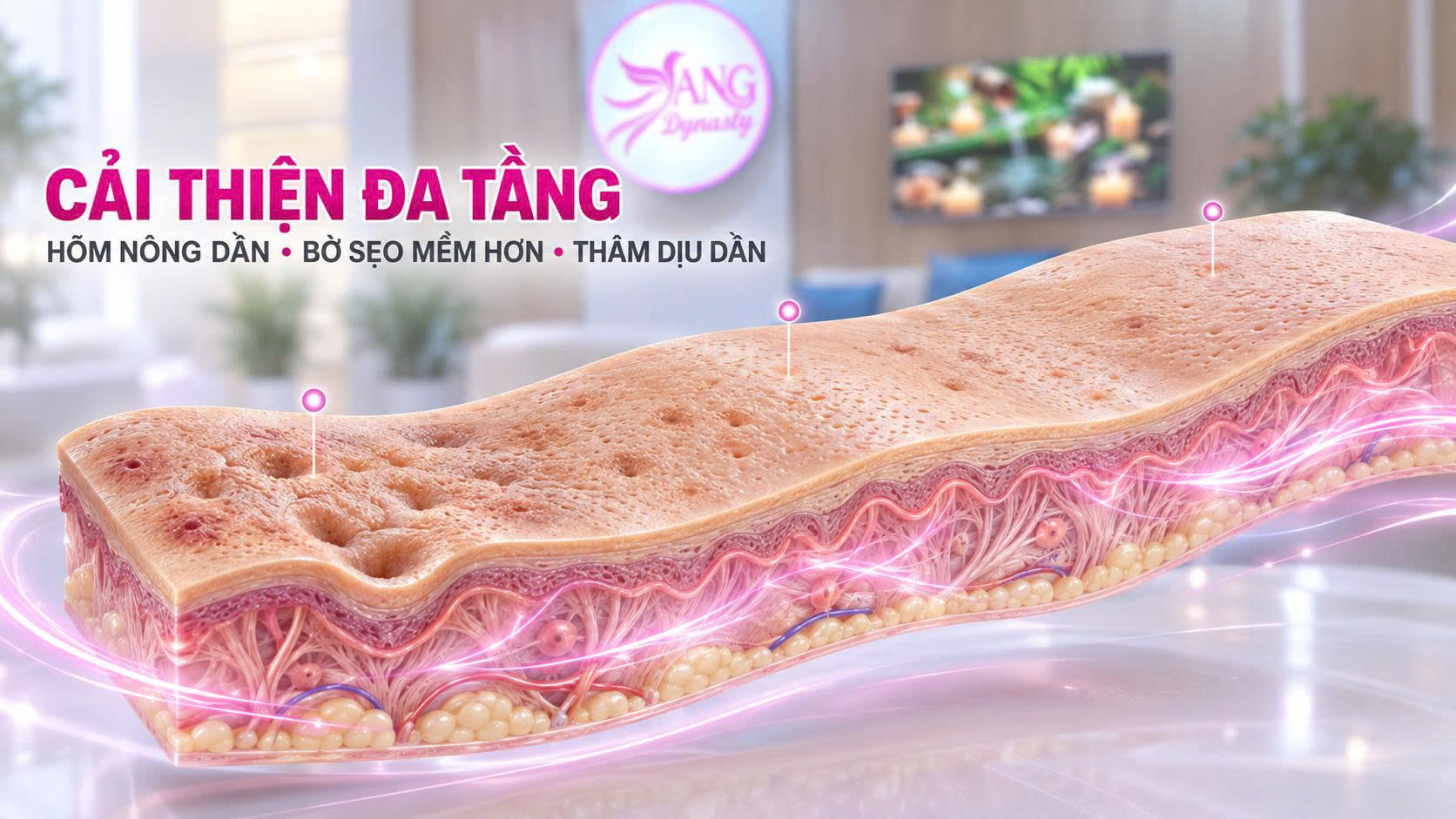 Trị Sẹo Sau Mụn Trị Sẹo Sau Mụn