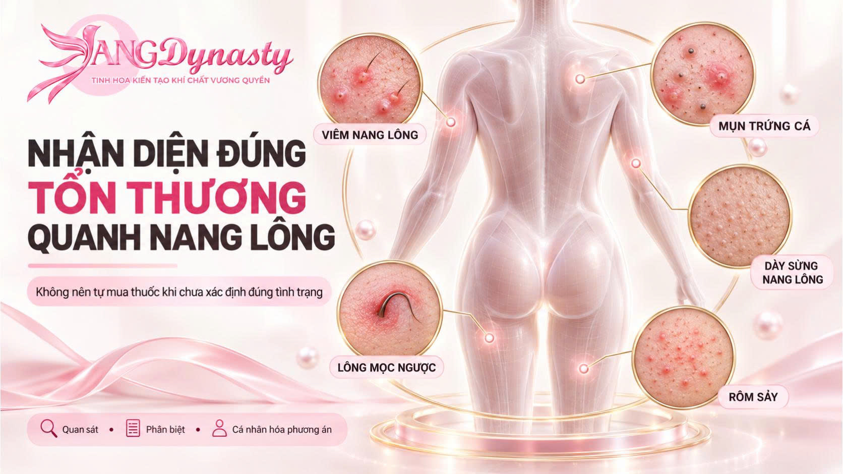 Viêm Nang Lông