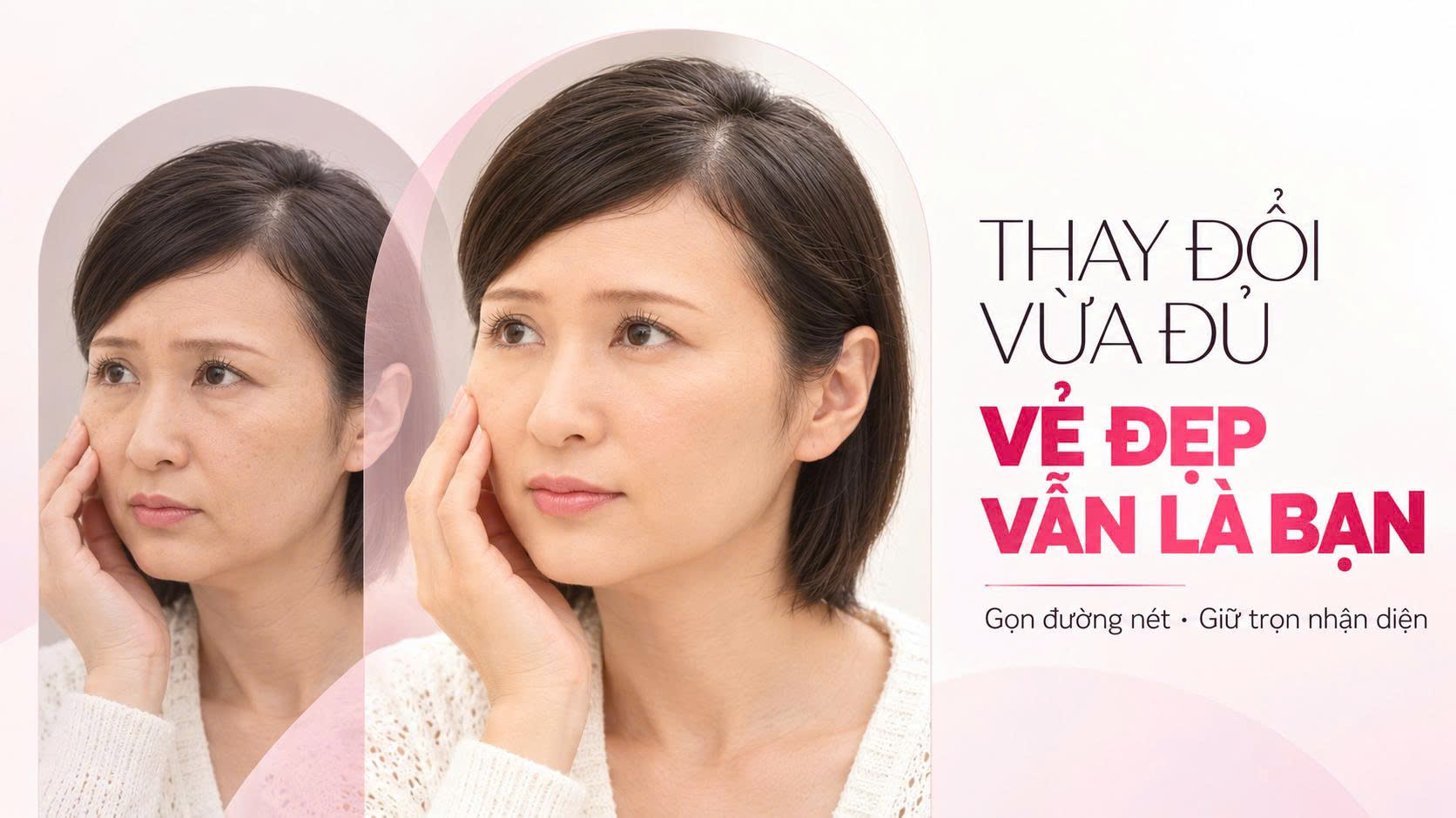Nâng cơ mặt Nâng cơ mặt