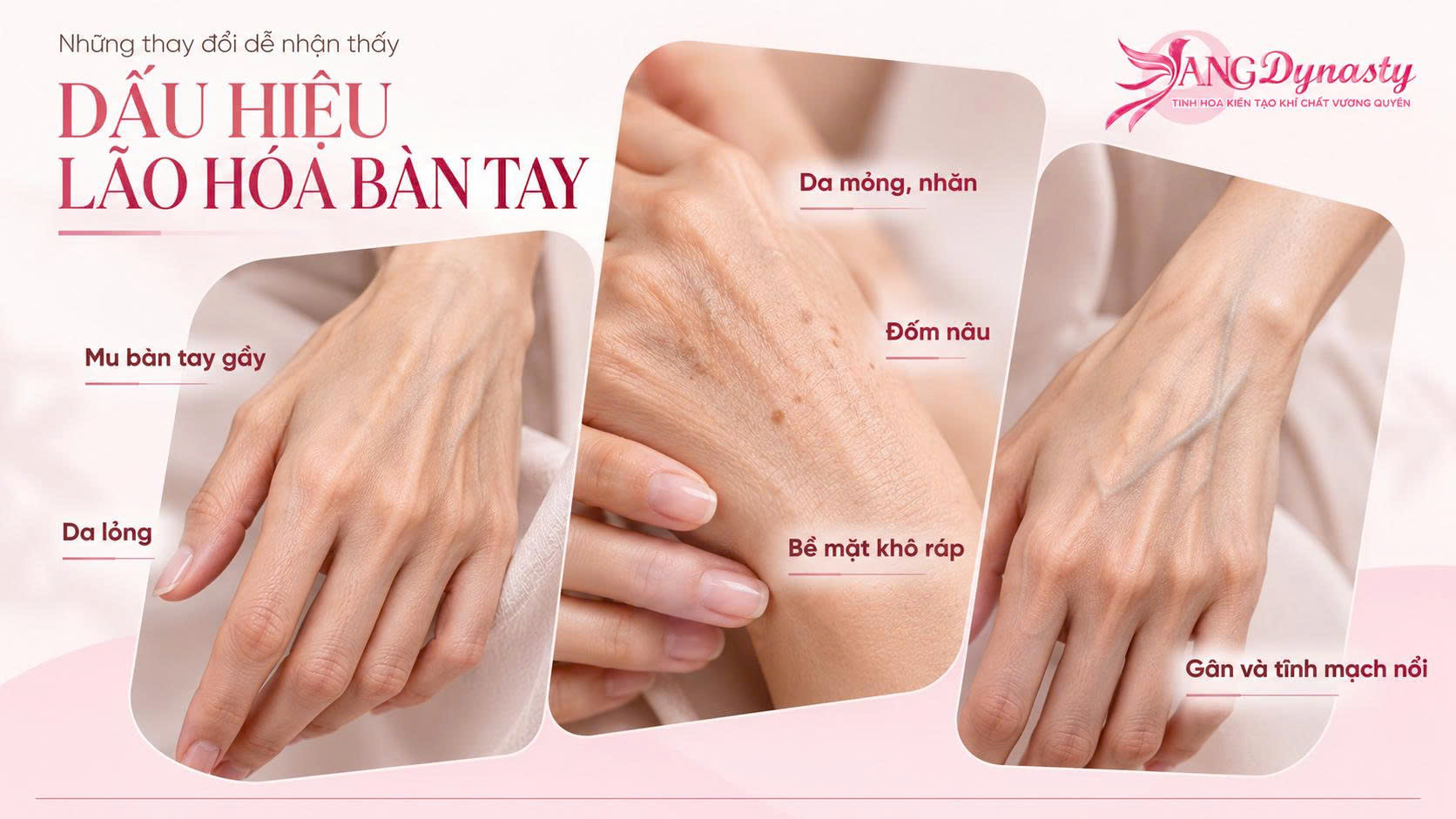 Trẻ Hoá Bàn Tay Trẻ Hoá Bàn Tay
