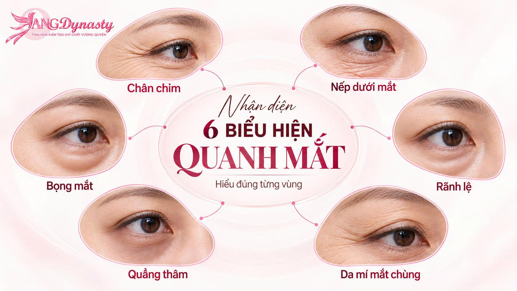 Xoá Nhăn Vùng Mắt Xoá Nhăn Vùng Mắt
