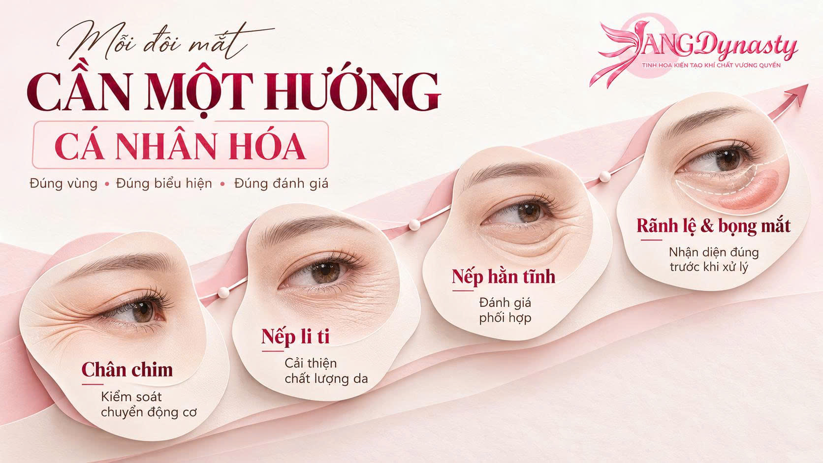 Xoá Nhăn Vùng Mắt Xoá Nhăn Vùng Mắt